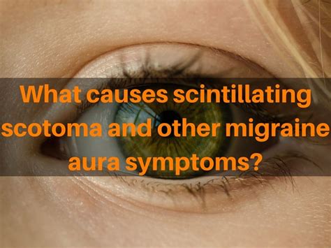 Scintillating scotoma causes with and without migraine headaches ...