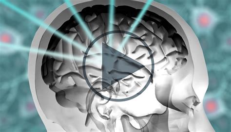 Stereotactic radiosurgery for brain metastases and the questionable role of whole-brain ...