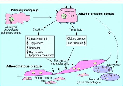 Chlamydia pneumoniae and coronary heart disease | The BMJ