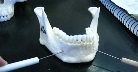 Boned: Human Skull - mental foramen (of mandible)