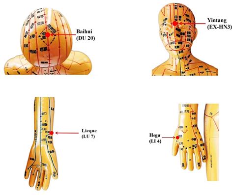 Frontiers | Efficacy and safety of acupuncture combined with auricular ...