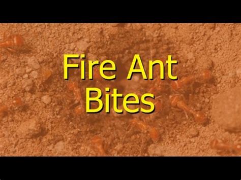 Images Of Fire Ant Bites