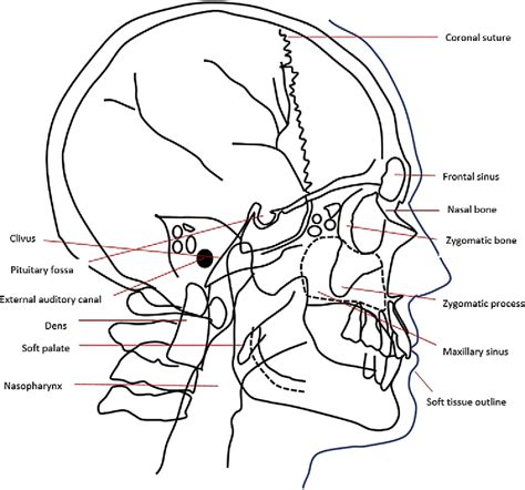 Figure 12 from Oral and Maxillofacial Anatomy. | Semantic Scholar