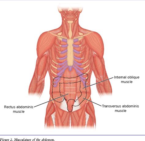 [PDF] Parastomal hernia: incidence, prevention and treatment strategies ...