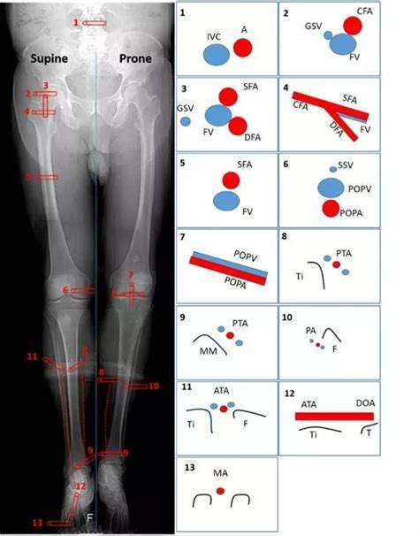 DVT Entire Leg - Anatomy | Medical ultrasound, Ultrasound physics ...