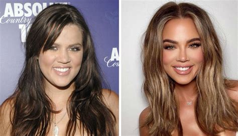 Khloe Kardashian's 'entire new face' leaves fans 'freaked out' amid ...