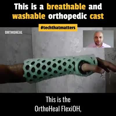 Waterproof And Breathable Arm Cast