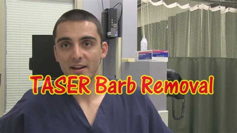 TASER Barb Removal - YouTube