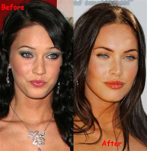 Celebrity Secret: Megan Fox - Lips and Nose Surgery | celebrity before ...