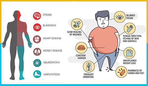 Top 8 Symptoms Of Type 2 Diabetes | Diabetes Treatment Guide, Diabetes ...