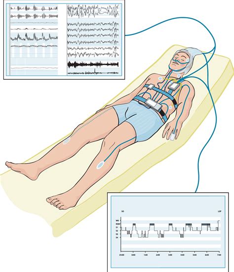 BioMedInformatics | Free Full-Text | Unobtrusive Monitoring of Sleep ...