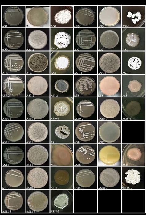 Colour and morphology of Streptomyces spp. that are isolated from ...