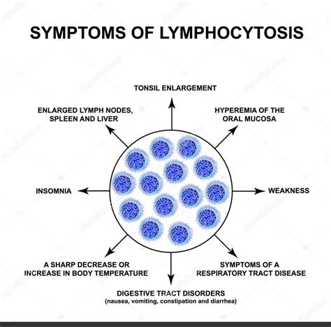 Absolute Lymphocyte Count (ALC): How Important is ALC in Disease ...