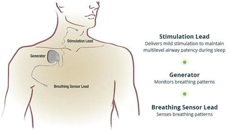 Sleep Apnea and Snoring in Southwest Ohio | Southwest Ohio ENT Specialists