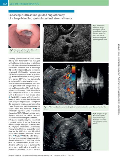 (PDF) Endoscopic ultrasound-guided angiotherapy of a large bleeding ...