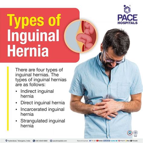 Inguinal Hernia - Signs and Symptoms, Types, Causes, Risk Factors