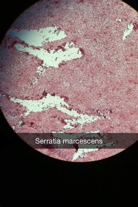 Serratia Marcescens Under Microscope