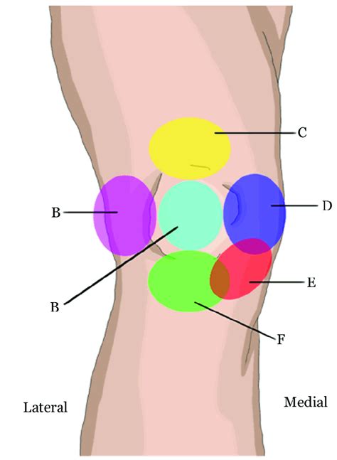 Self Diagnosing Knee Pain | Vancouver Chiropractic Care