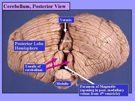 GROSS ANATOMY OF THE BRAIN Dr G R