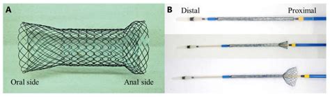 The newly developed proximal release-type colonic stent. (A): The... | Download Scientific Diagram