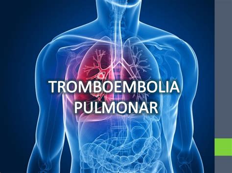 TROMBOEMBOLIA PULMONAR TEP