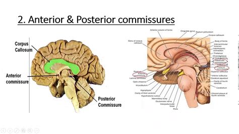 Neuroanatomy Cerebrum White Matter - YouTube