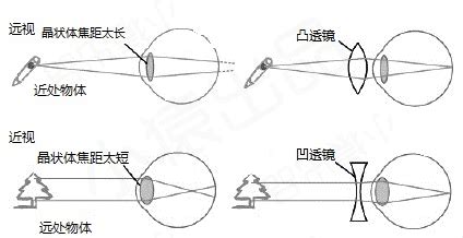 近视眼远视眼原理图,近视眼远视眼示意图 - 伤感说说吧