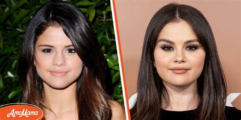 Selena Gomez & Plastic Surgery: Experts Claim She Had Work Done