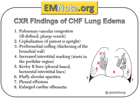 Pulmonary Edema Signs And Symptoms