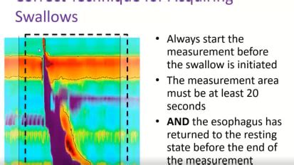 Esophageal Manometry - Diversatek University