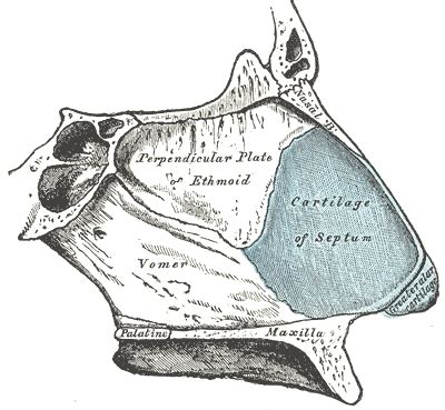 Nasal septal abscess - Wikipedia