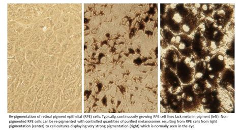 Re-pigmented RPE cells - University of Eastern Finland