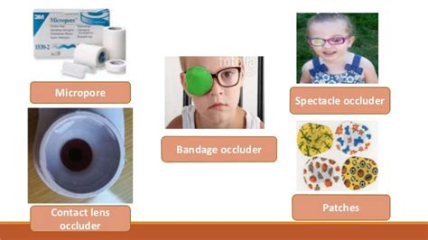 Amblyopia : classification & Occlusion therapy