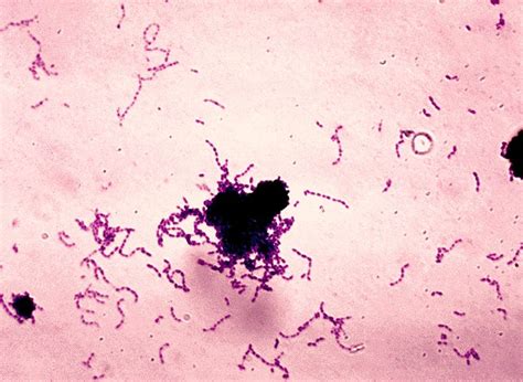 Bacterial Diseases of the Mouth | Boundless Microbiology