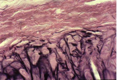 Histology Doodles: Elastic fibers made from chondroblasts and chondrocytes (Cartilage)