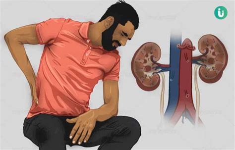 Conn Syndrome symptoms, causes, treatment, medicine, prevention, diagnosis