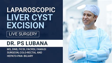 Laparoscopic LIVER Cyst Excision | Live Surgery | Dr. PS Lubana - YouTube