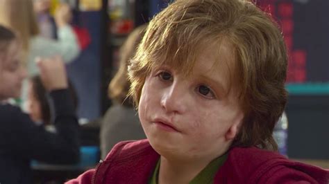 What “Wonder” Gets Wrong About Disfigurement and Craniofacial Disorder ...