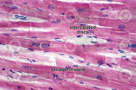 Cardiac Muscle Slides