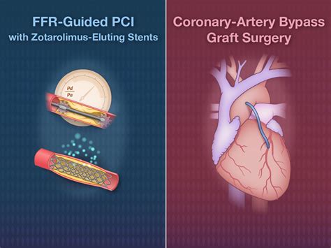 FFR-Guided PCI vs. Coronary Bypass Surgery | NEJM