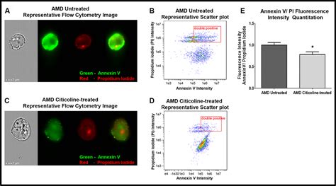 Role of Citicoline in an in vitro AMD model - Figure f1 | Aging