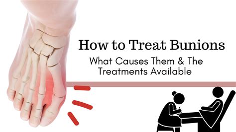 How To Treat Bunions - Kim Holistic Foot & Ankle Center