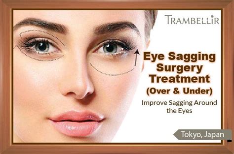 Eye Sagging Surgery Treatment (Improve Sagging Around the Eyes) | Trambellir