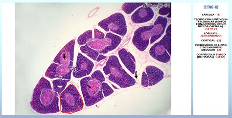 Timo Histologia