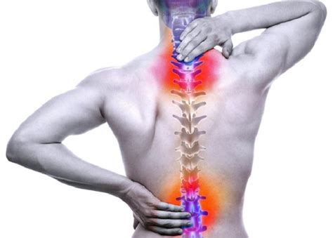 Spinal Cord Injury: Types of Injuries, Symptoms and Treatment - Scope Heal