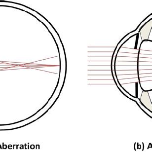 Higher order aberrations of the eye. (a) Spherical aberration with... | Download Scientific Diagram