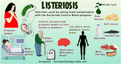 What Type of Bacteria Causes Listeriosis? [UPSC Notes Download]