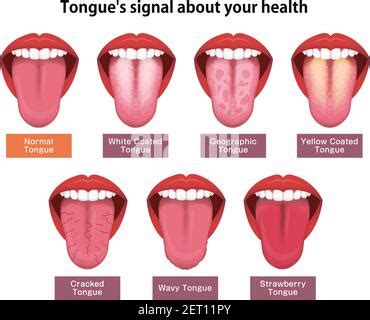 Healthy Tongue Color