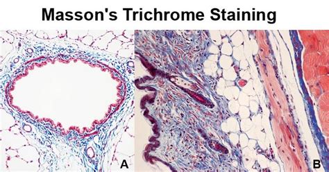 Staining Notes - Microbe Notes