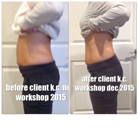 All New Before and After Pictures – Healing the Diastasis Recti 2015 – Beautiful After the Belly